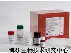 人白細(xì)胞共同抗原ELISA試劑盒_供應(yīng)產(chǎn)品_博研生物技術(shù)研究中心